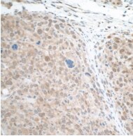 STAT3 Antibody (BLR098G)