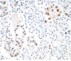 STAT3 Antibody (BLR098G)