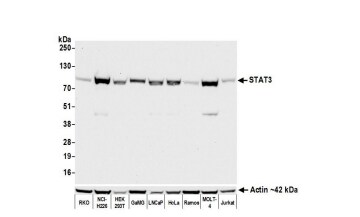 STAT3 Antibody (BLR098G)