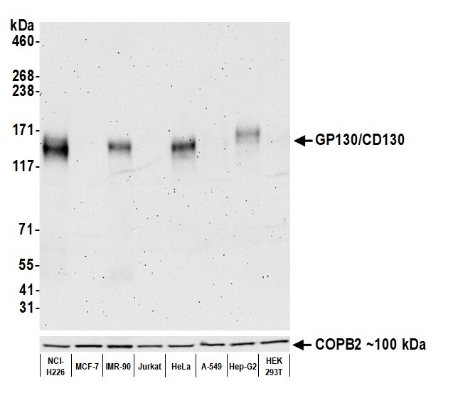 gp130/CD130 Antibody (BLR114H)