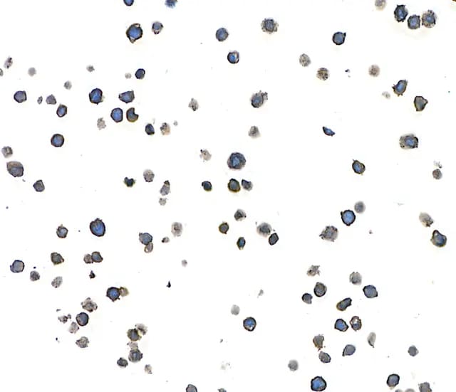 CD38 Antibody (BLR123H)