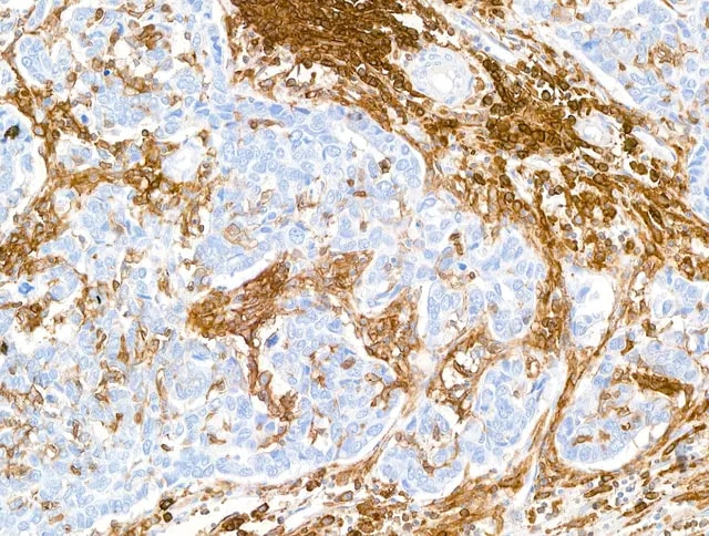 CD38 Antibody (BLR123H)