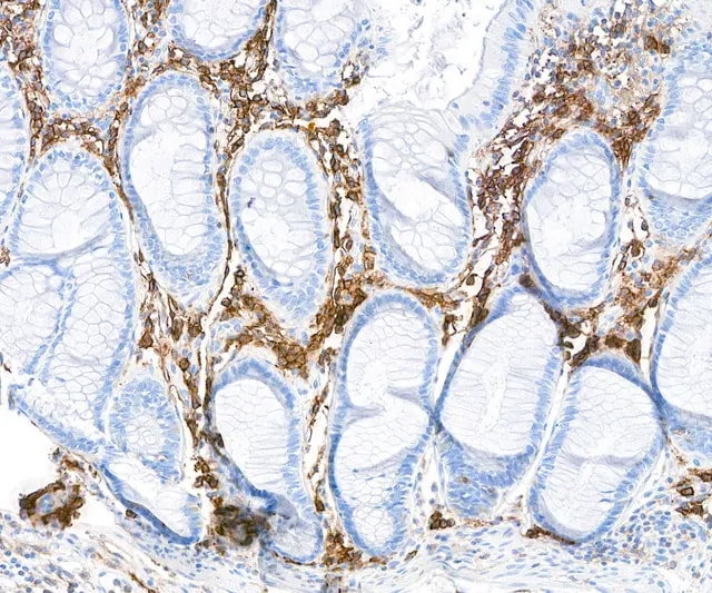 CD38 Antibody (BLR123H)