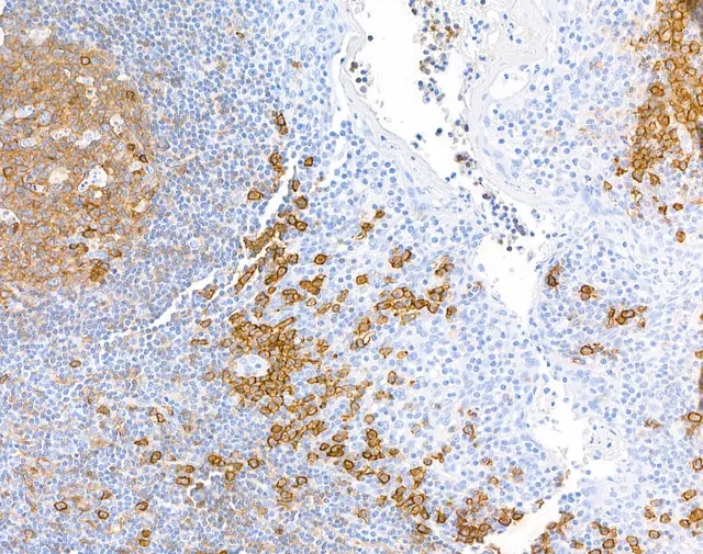 CD38 Antibody (BLR123H)
