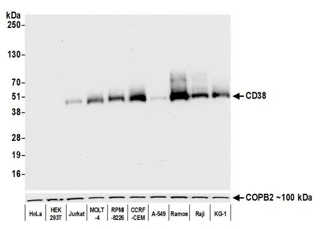 CD38 Antibody (BLR123H)