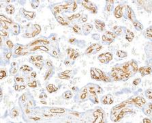 CD31/PECAM-1 Antibody (BLR127H)
