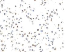 CD11c Antibody (BLR138H)