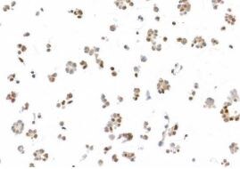 UBQLN4/CIP75 Antibody (BLR145J)