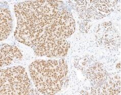 UBQLN4/CIP75 Antibody (BLR145J)