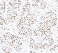 STAT6 Antibody (BLR147J)