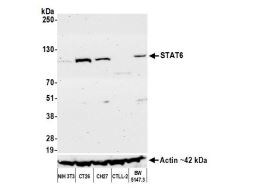 STAT6 Antibody (BLR147J)