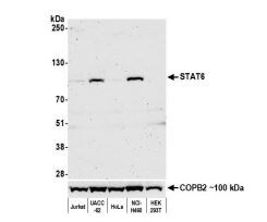STAT6 Antibody (BLR147J)
