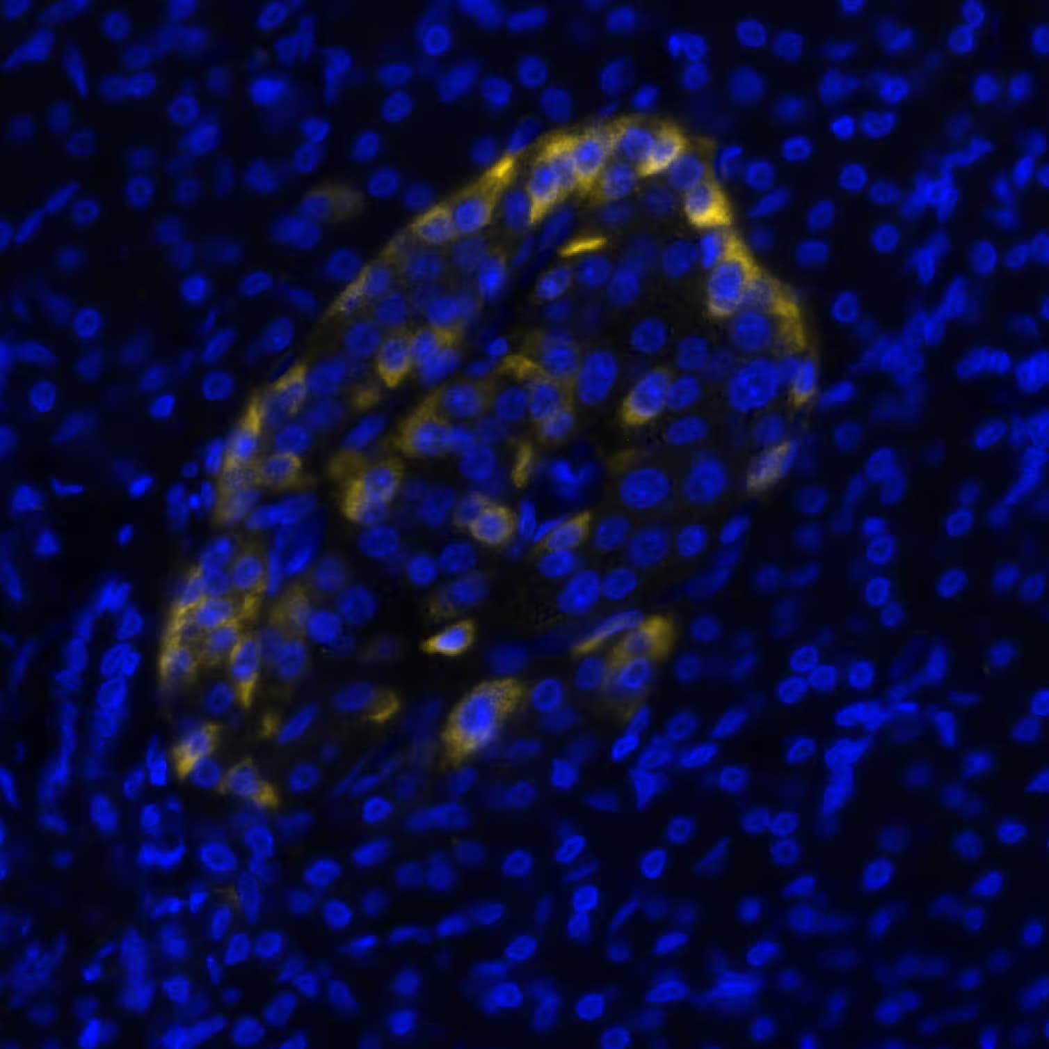 Fibroblast Activation Protein alpha/FAP Antibody (BLR150J) Detection of FAP in Human Pancreas via seqIF™ staining on COMET™