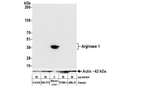 Arginase 1/ARG1/liver Arginase Antibody (BLR161J)