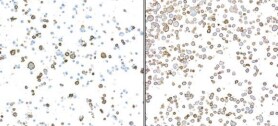 Fc gamma RIIIB/CD16b Antibody (BLR163J)