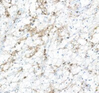 Fc gamma RIIIB/CD16b Antibody (BLR163J)