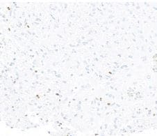 ASCL1/Mash1 Antibody (BLR164J)