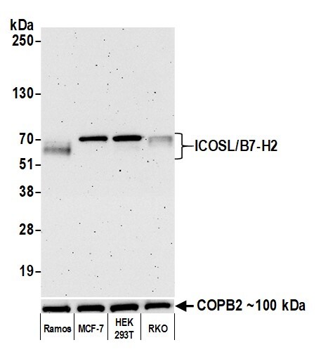 B7-H2/ICOSLG Antibody (BLR166J)