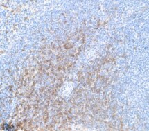 CD8 Antibody (BLR173J)