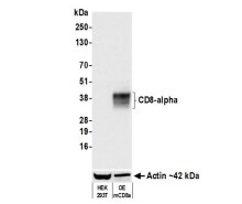 CD8 Antibody (BLR173J)