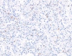 IL-7R alpha/CD127 Antibody (BLR177J)