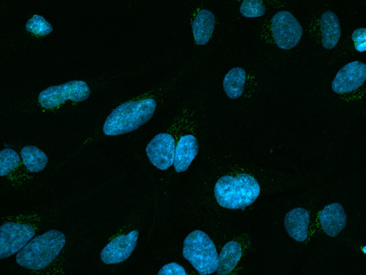 TSPAN3 Antibody - BSA Free