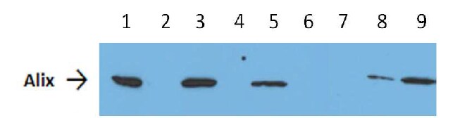 Tumor-Derived Exosome Isolation Beads