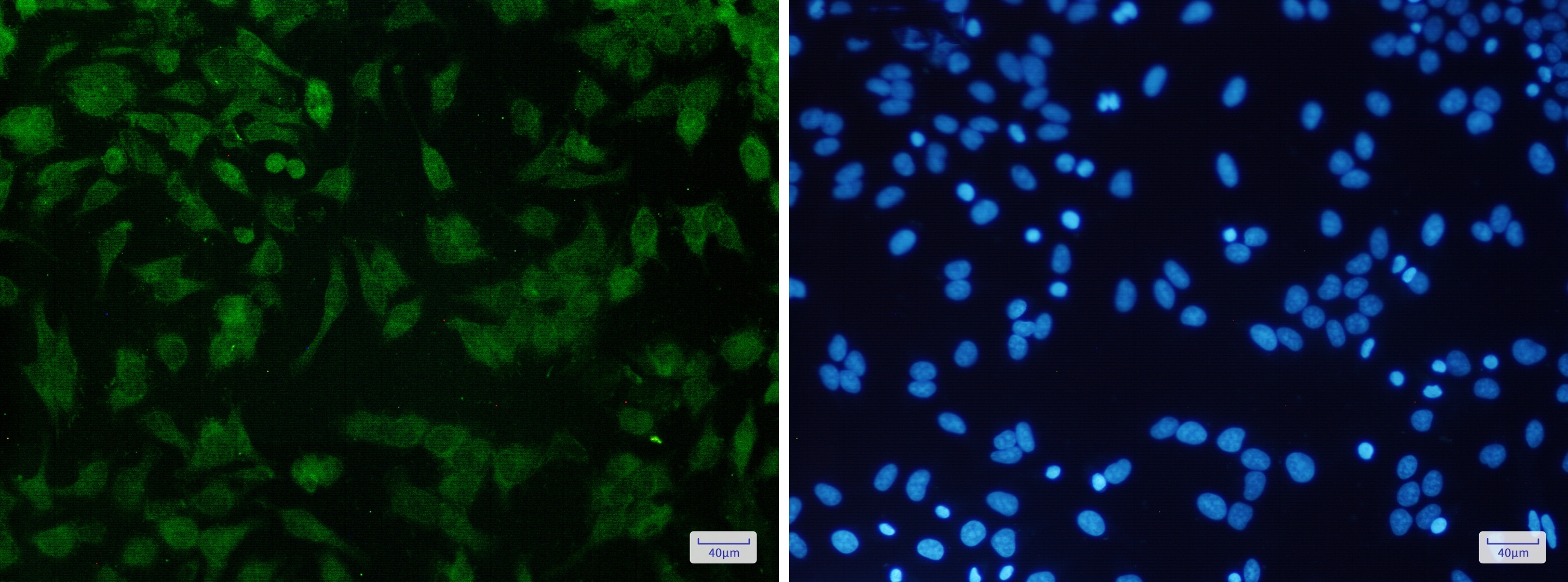 p16INK4a/CDKN2A Antibody (S04-8C9)