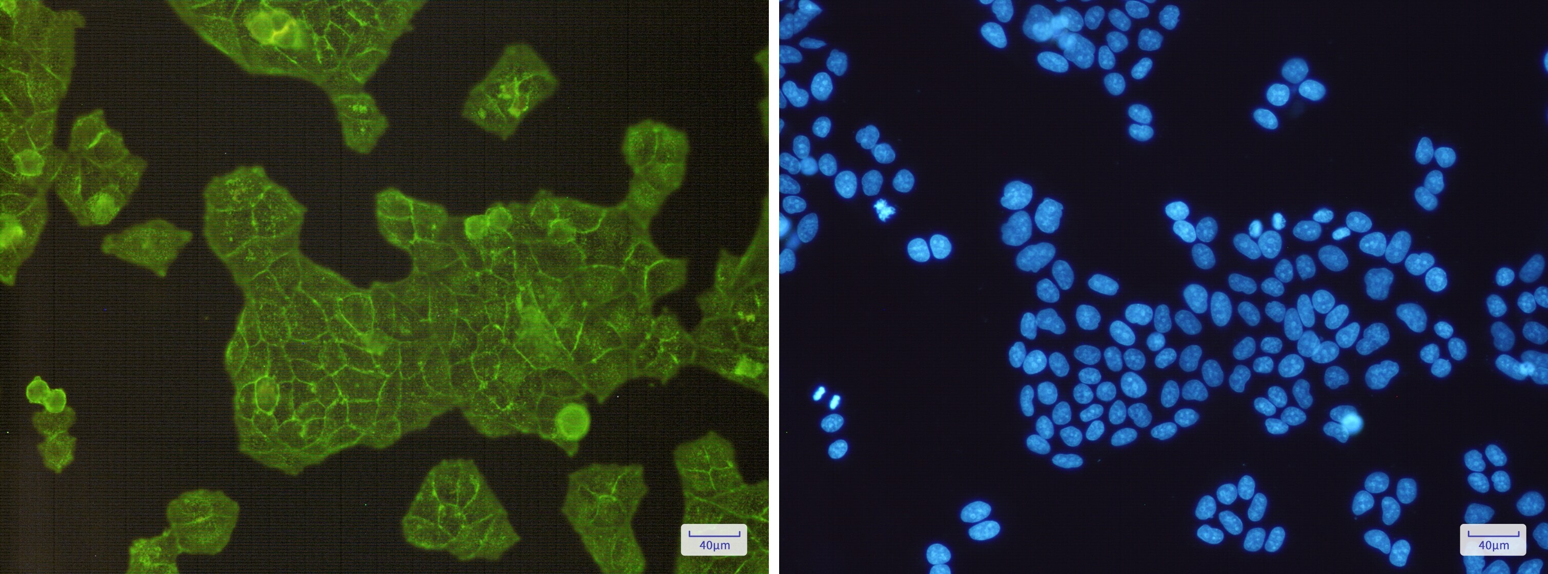 Alpha Actinin 4 Antibody (S06-3D7)