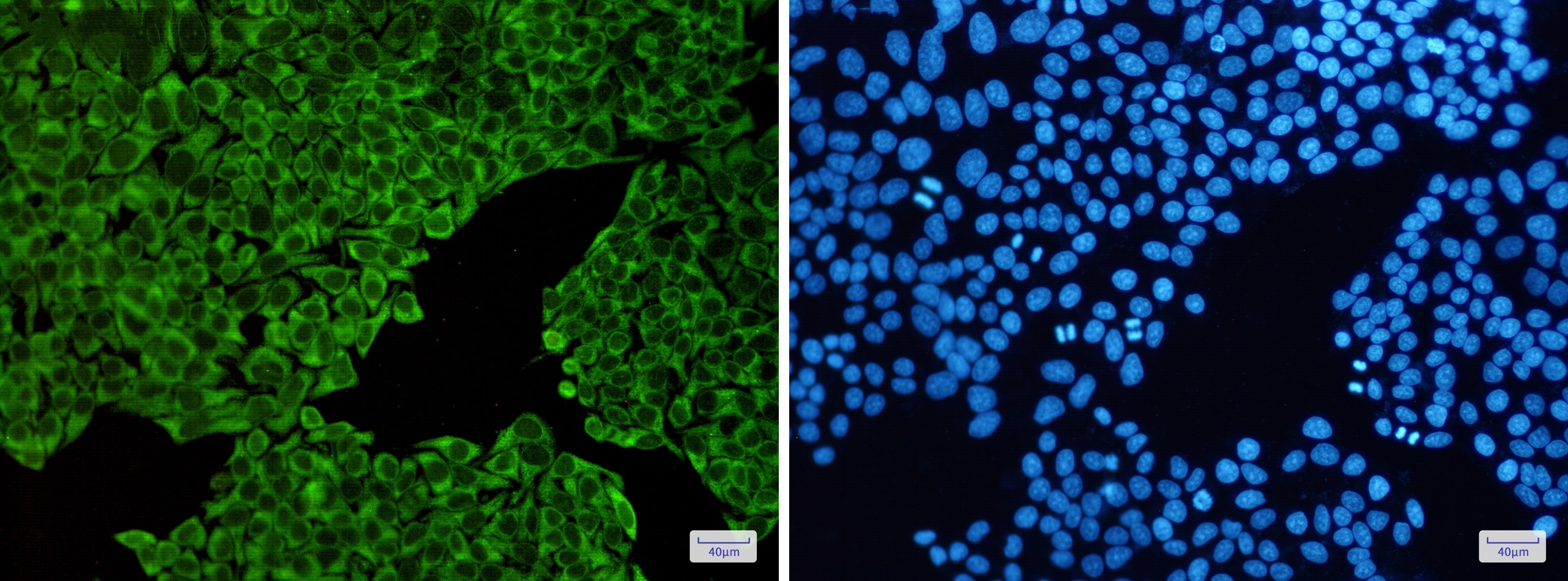 ENO3 Antibody (S07-5B2)