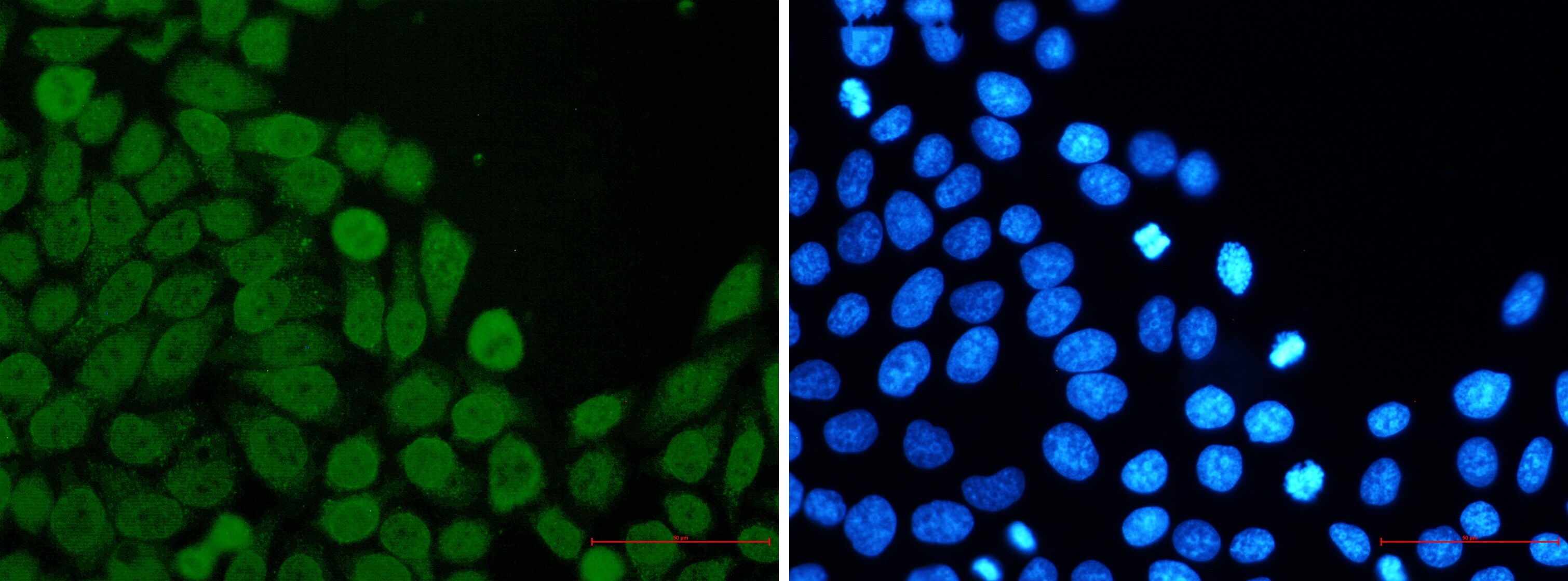 EIF4A3 Antibody (S05-1B7)