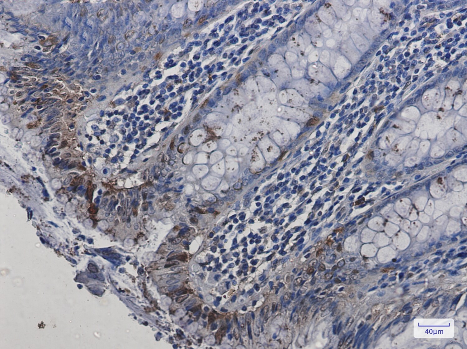 HSPA2 Antibody (S08-4A4)