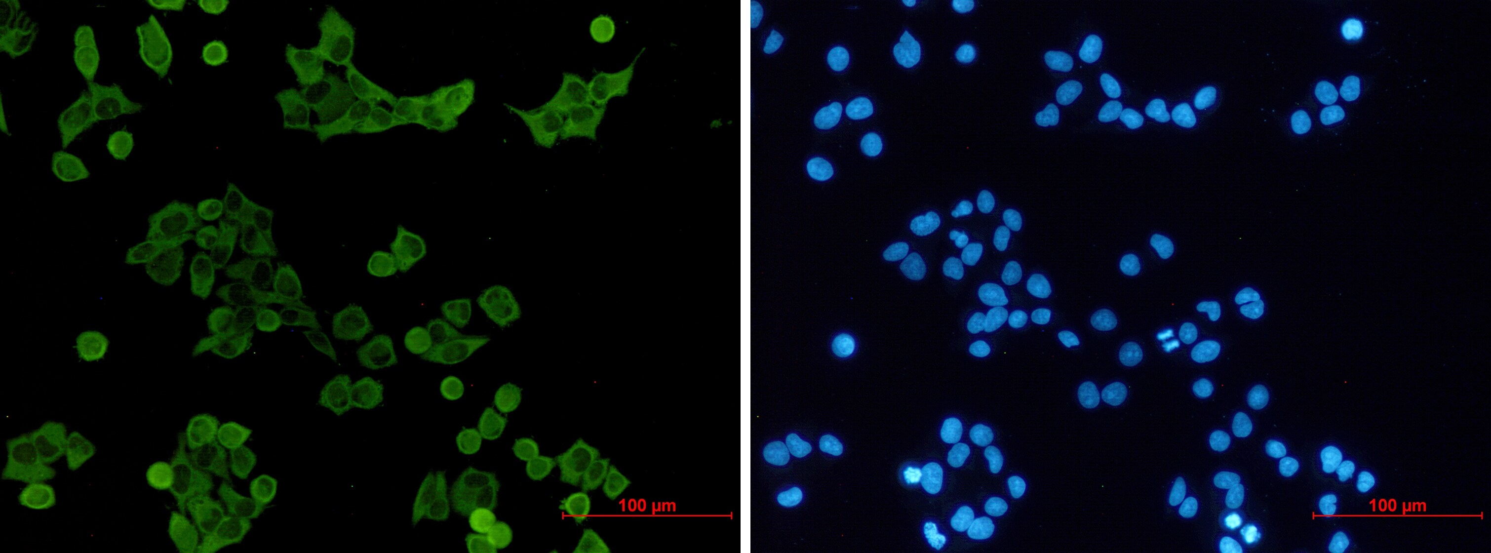 Hck Antibody (S02-5C1)