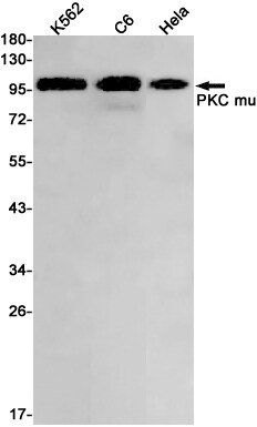 PKC mu Antibody (S05-4J5)