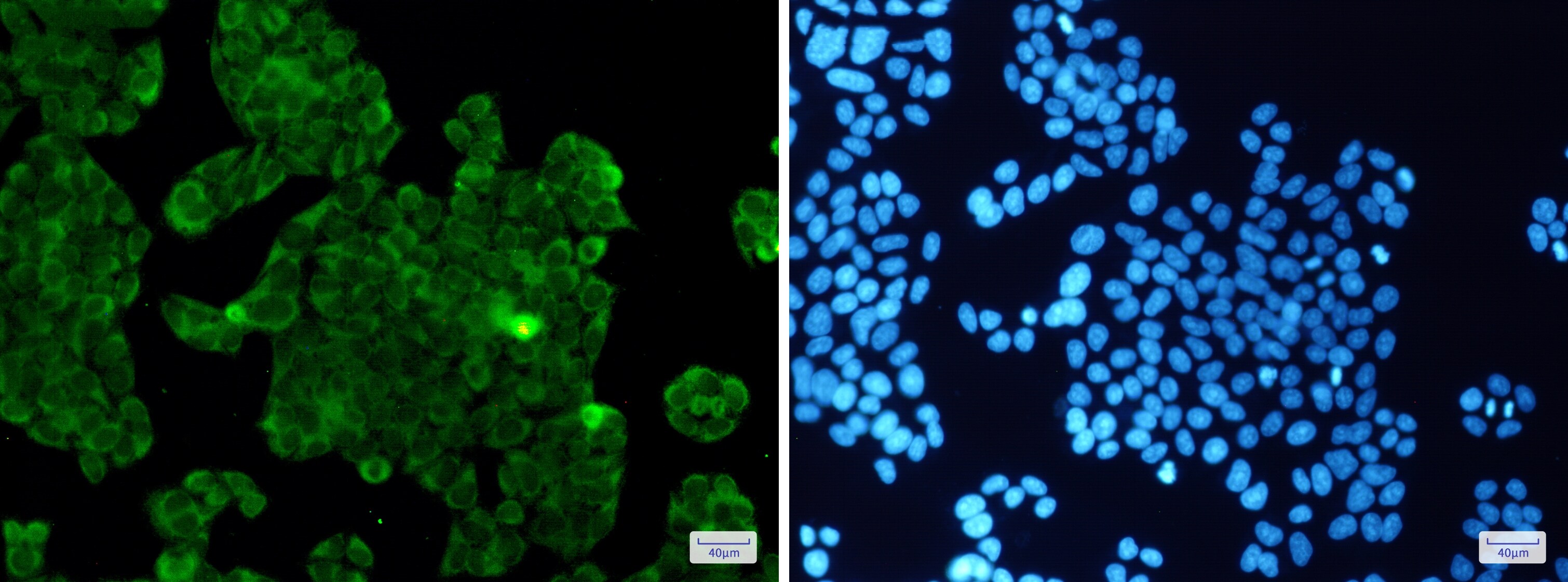 Protein Phosphatase 1 beta Antibody (S09-6B7)