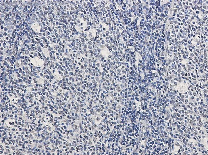 Rad51 Antibody (S04-3C6)