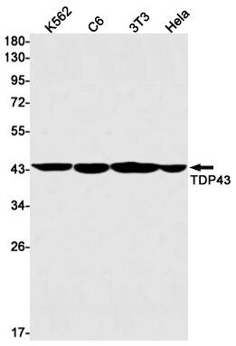 TDP-43/TARDBP Antibody (S02-2A8)