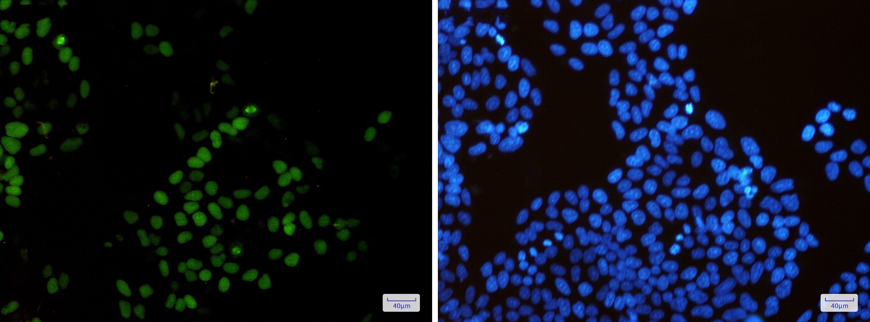 KIFC1 Antibody (S03-3E4)