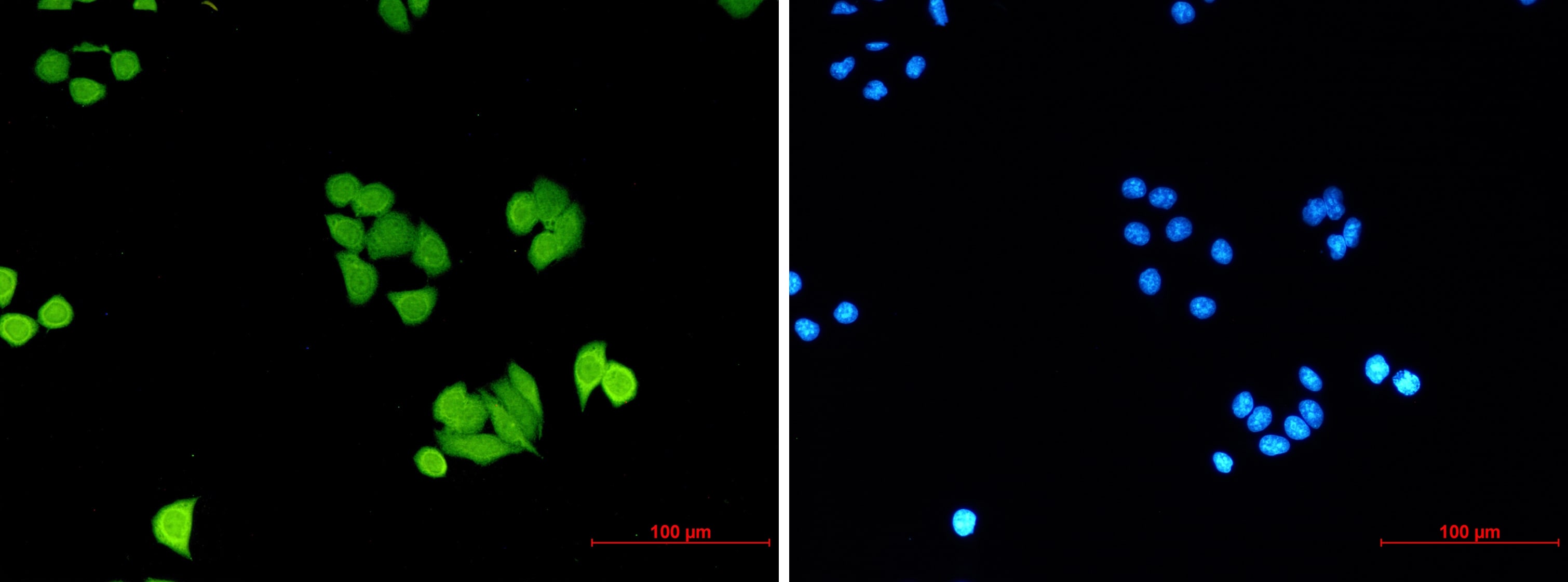 PLK1 Antibody (S07-3E0)
