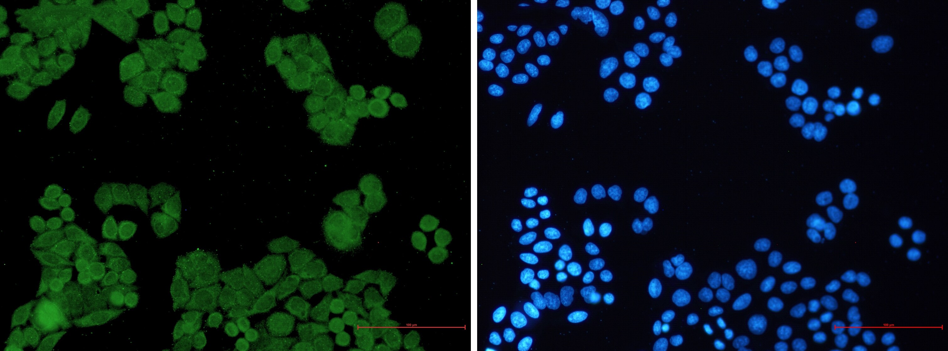 PP2A alpha/beta Antibody (S04-4G4)