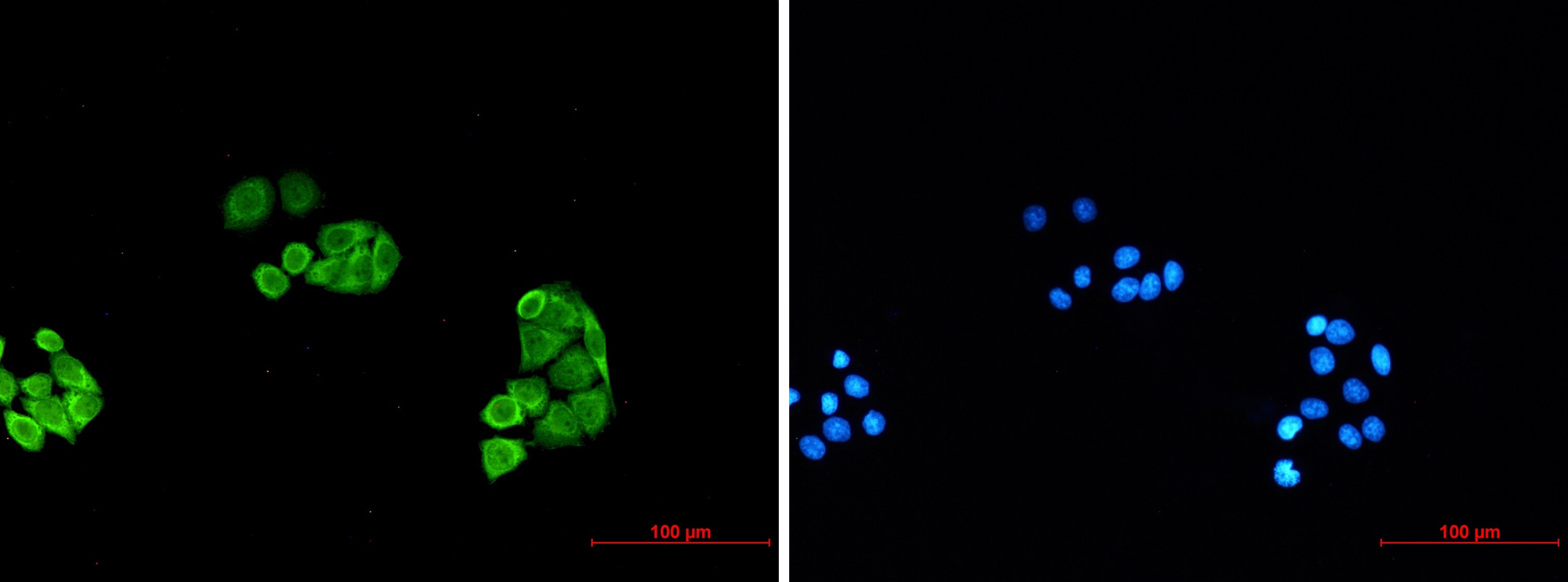 Proteasome 20S alpha 6 Antibody (S01-4I2)