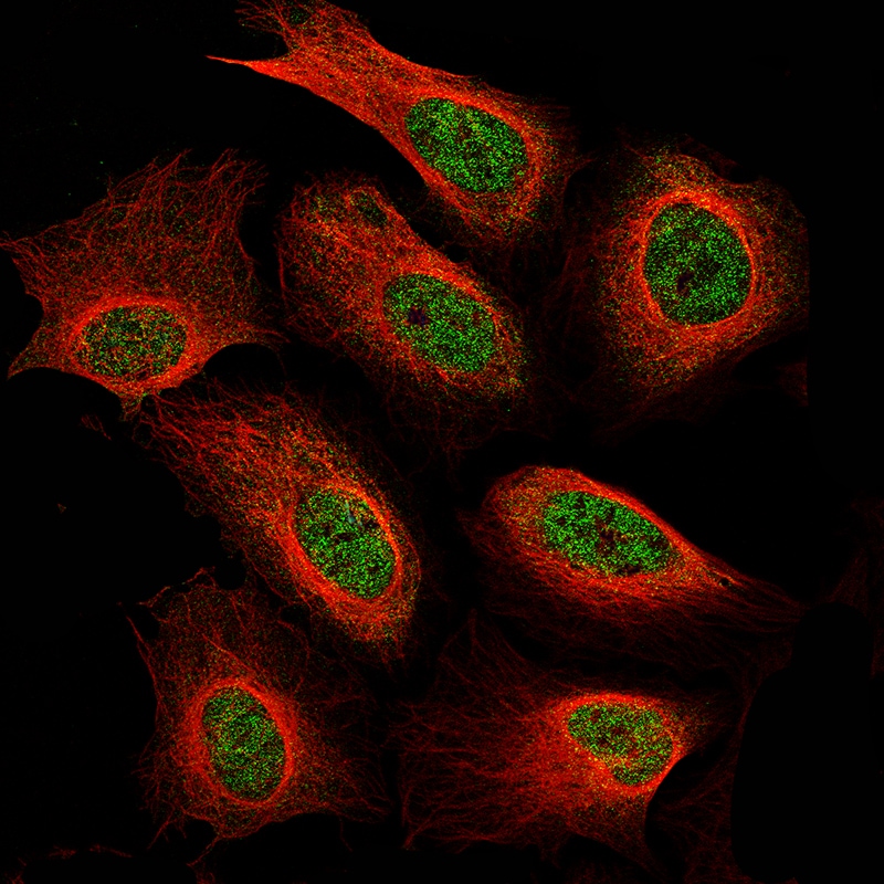 Neurofibromin 1 Antibody (CL11865) - BSA Free Immunocytochemistry/ Immunofluorescence: Neurofibromin 1 Antibody (CL11865) - BSA Free [NBP3-15123]