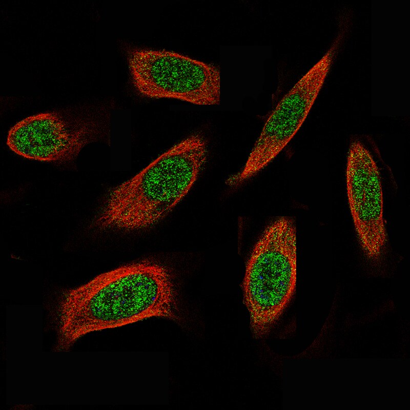 ID1 Antibody (CL11995) - BSA Free Immunocytochemistry/ Immunofluorescence: ID1 Antibody (CL11995) - BSA Free[NBP3-15127]