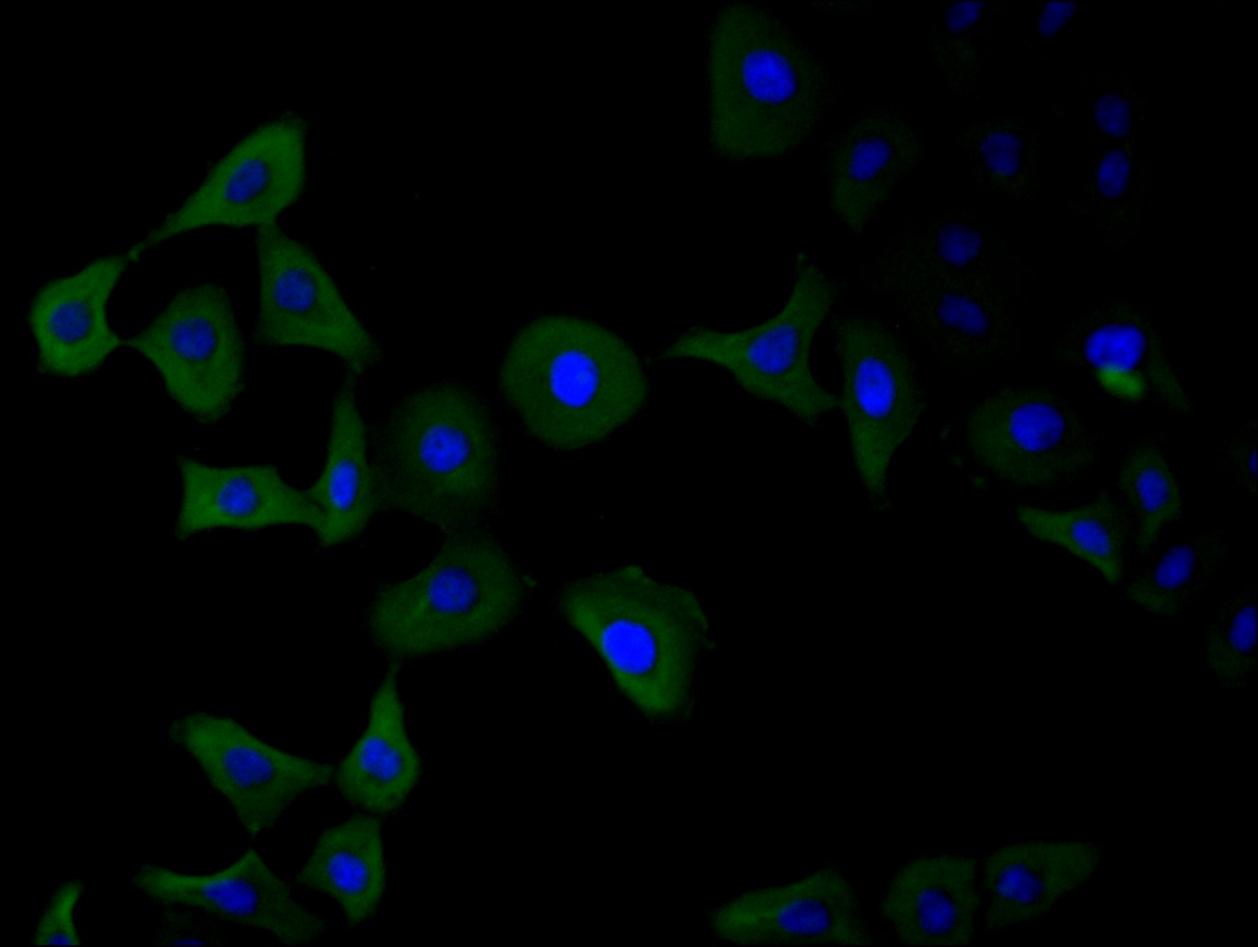 PAK1 Antibody (4F10)