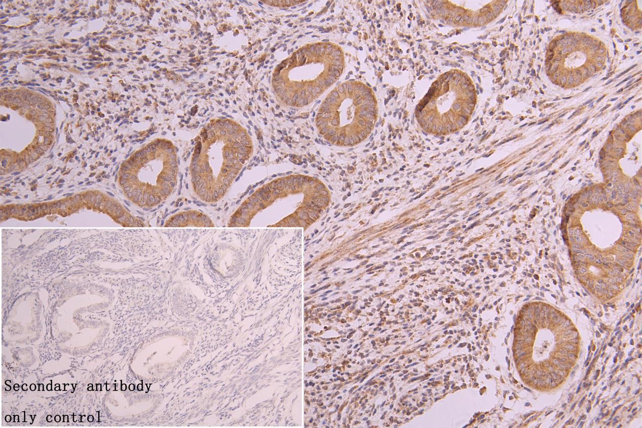 Muscarinic Acetylcholine Receptor M3/CHRM3 Antibody (2D4)