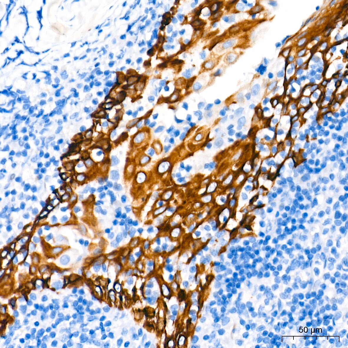Cytokeratin 4 Antibody (6H9R6)