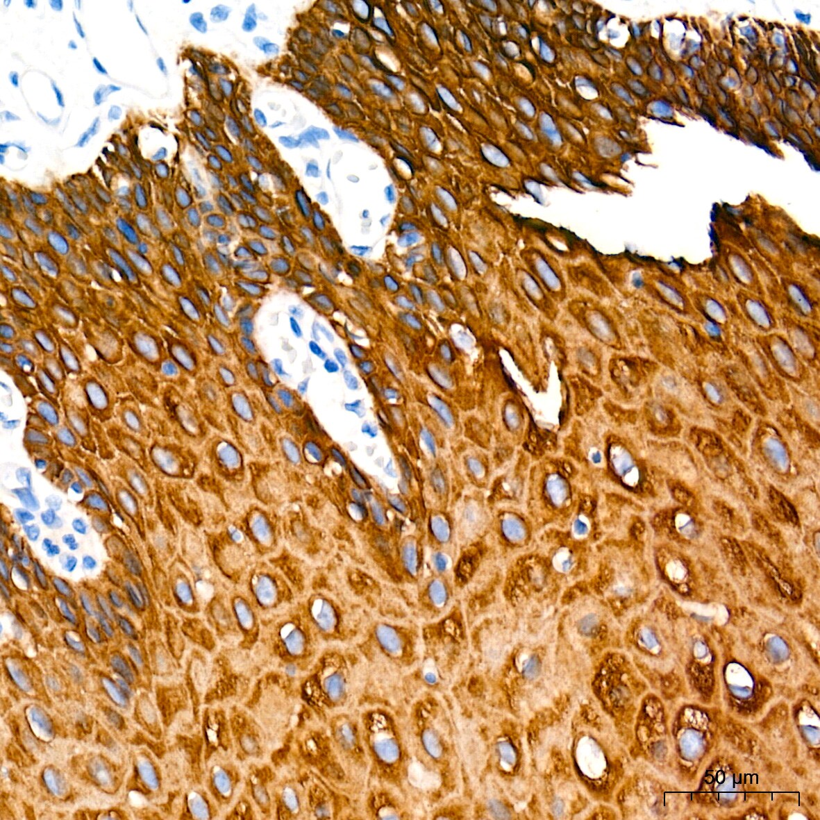 Cytokeratin 4 Antibody (6H9R6)