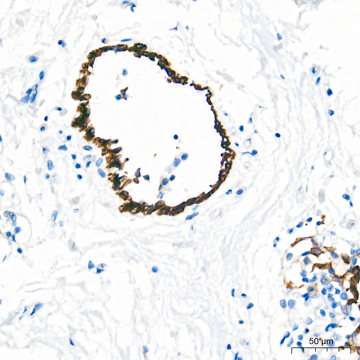 Cytokeratin 4 Antibody (6H9R6)
