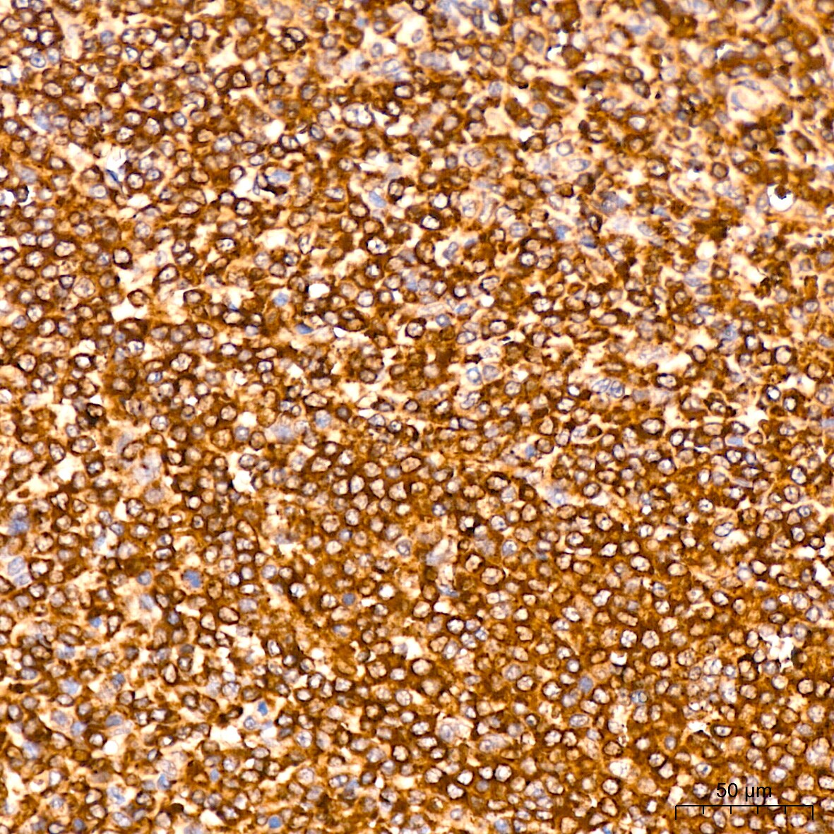 MMP-14/MT1-MMP Antibody (6T7L3)