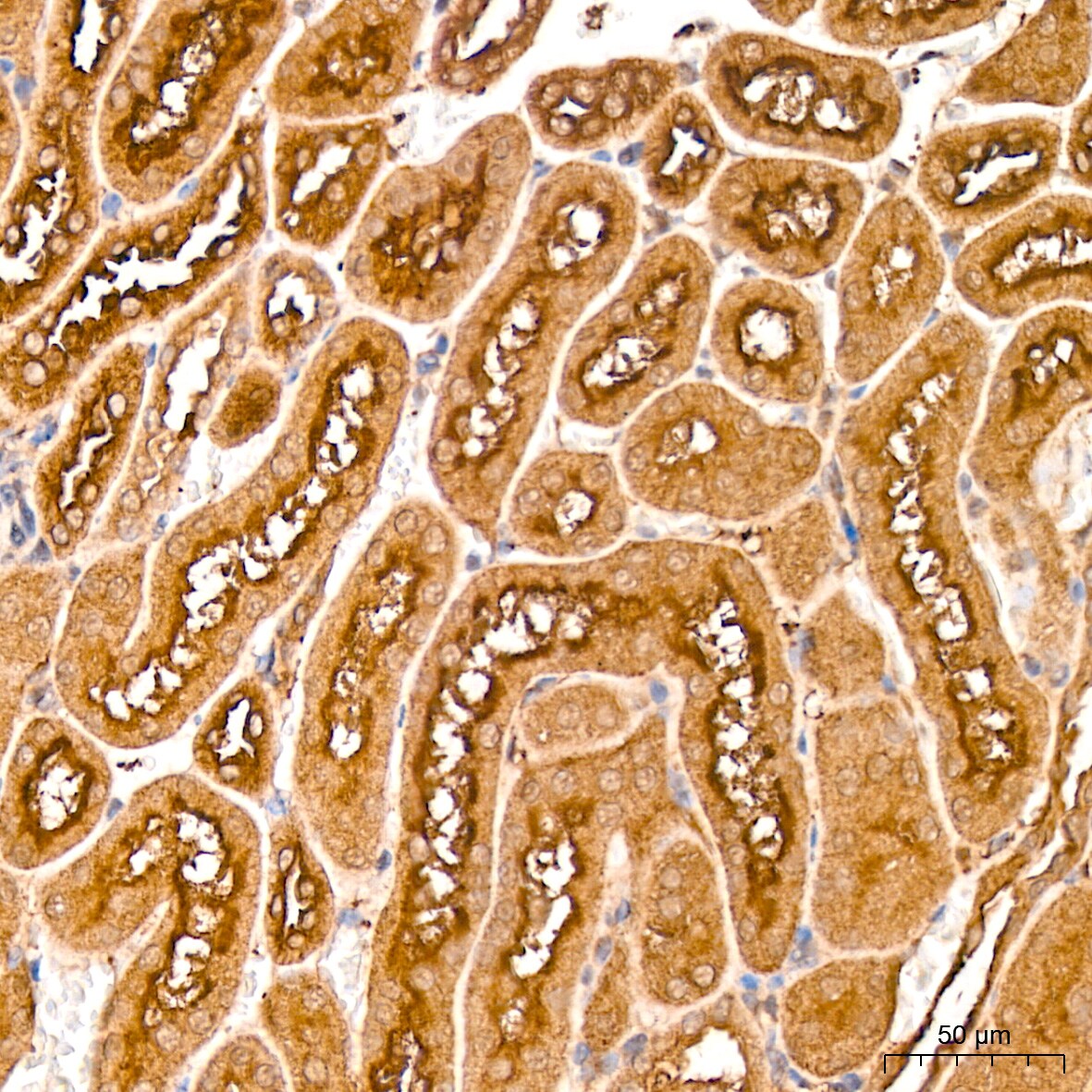 MMP-14/MT1-MMP Antibody (6T7L3)